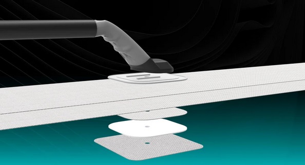 2026 Keylock-Winkelgriffaufsätze